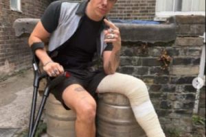 Yungblud promet de poursuivre ses dates de festival européen après s&rsquo;être cassé la jambe dans un accident de moto