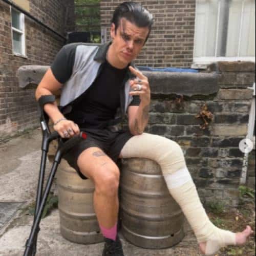 Yungblud promet de poursuivre ses dates de festival européen après s'être cassé la jambe dans un accident de moto