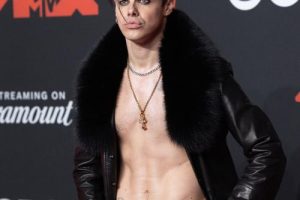 Yungblud se casse la jambe dans un accident de moto